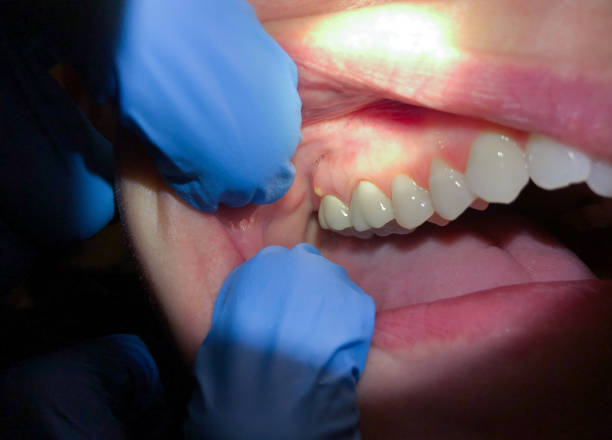 Best Emergency Dental Care for Trauma or Injury in Richwood, NJ