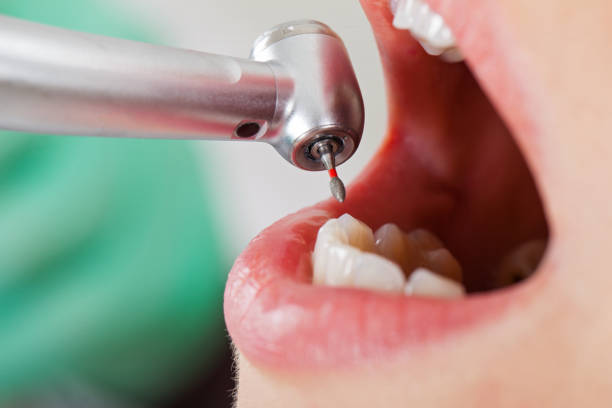 Best Pediatric Emergency Dentist in Richwood, NJ